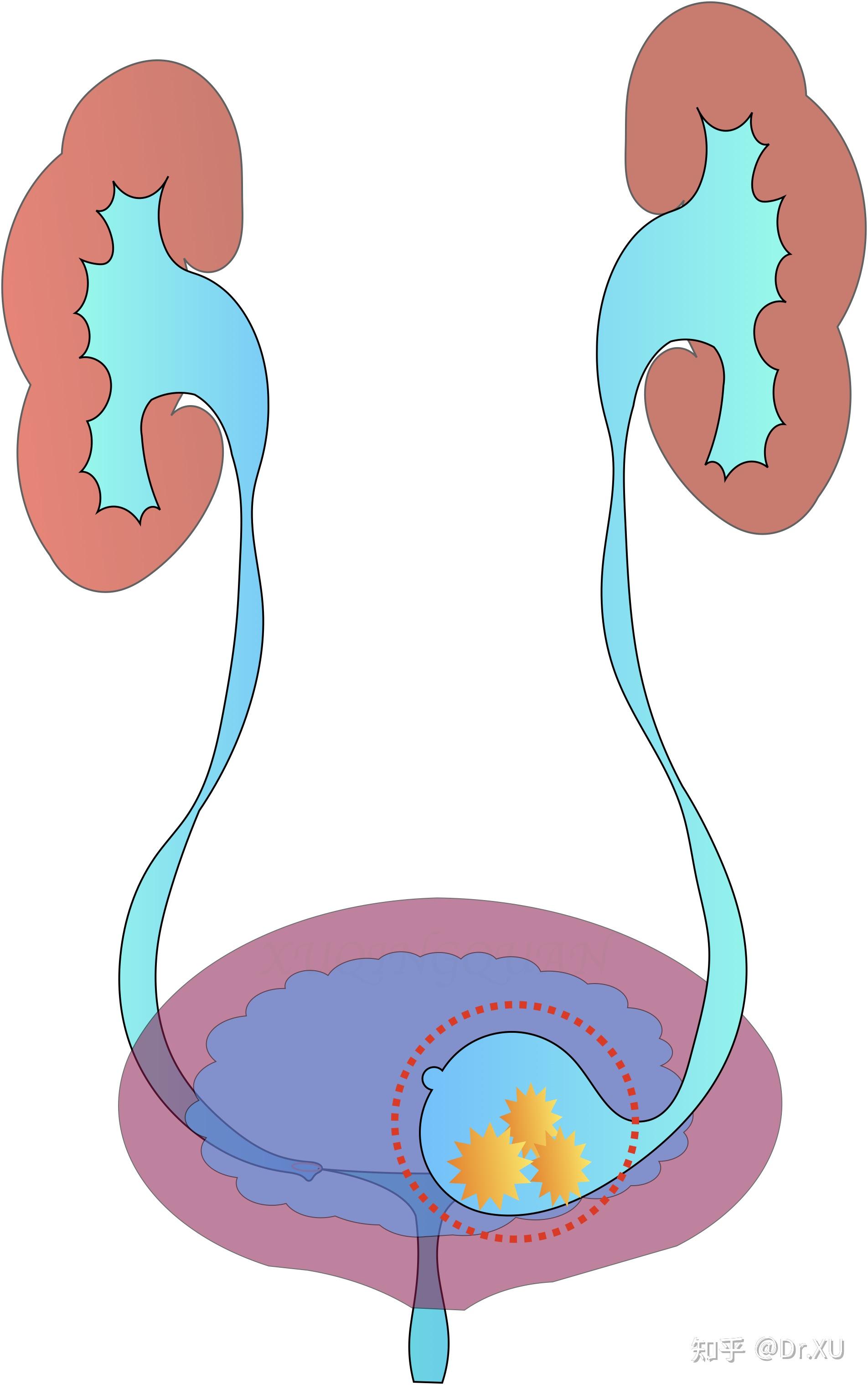 图2-3-2 肾盂和输尿管经静脉排泄尿路造影-基础医学-医学