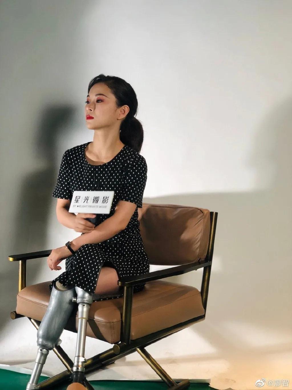 35岁的廖智,经常找不到自己的腿.