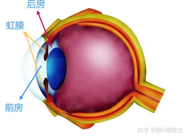 虹膜隐窝位置图片