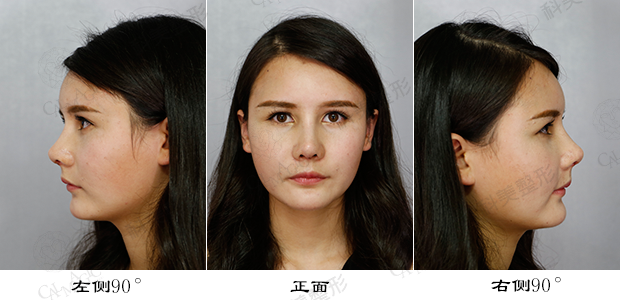 标准鼻子照片要求