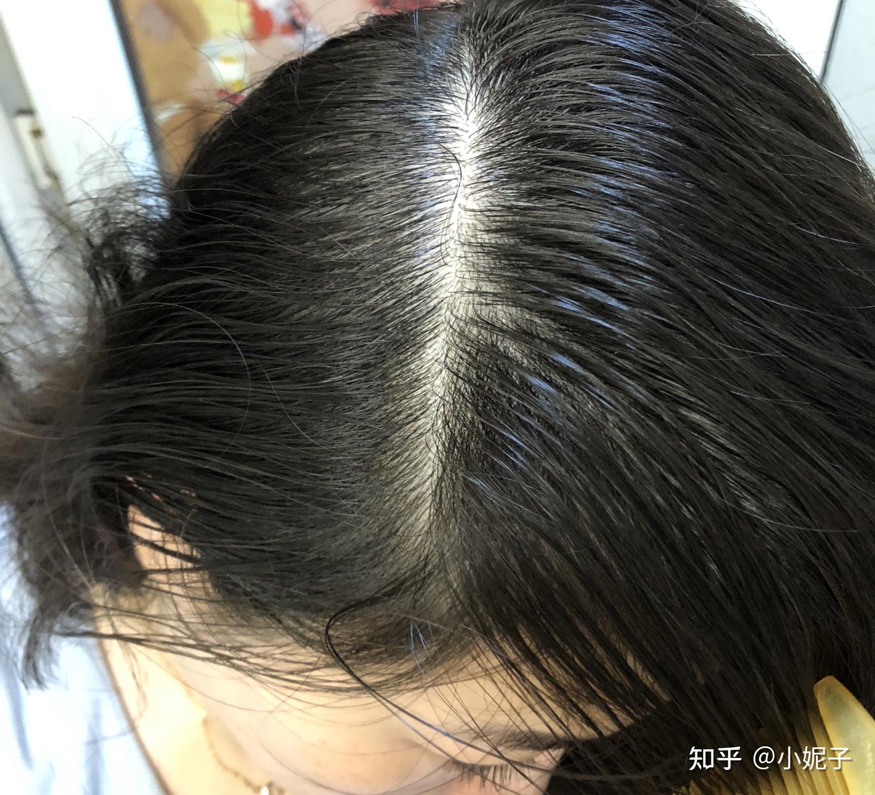 看起来是不是有一种都快秃了的感觉!