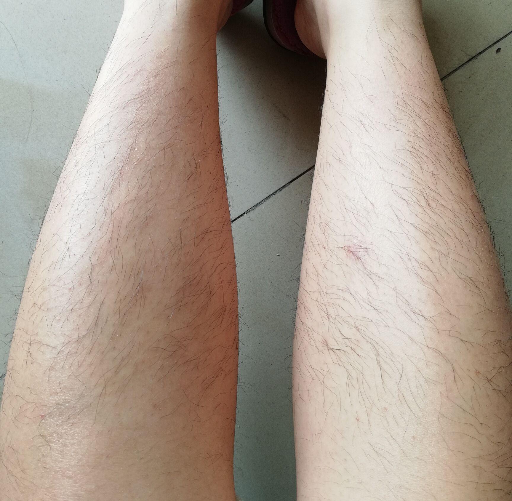 女生腿毛旺盛是怎样的人生体验