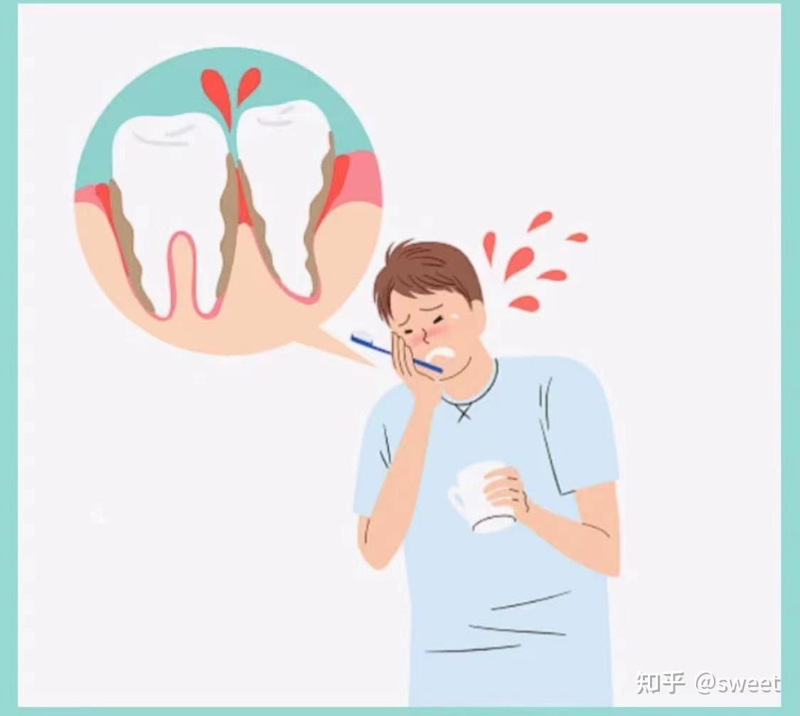 牙痛是什么原因引起的图片