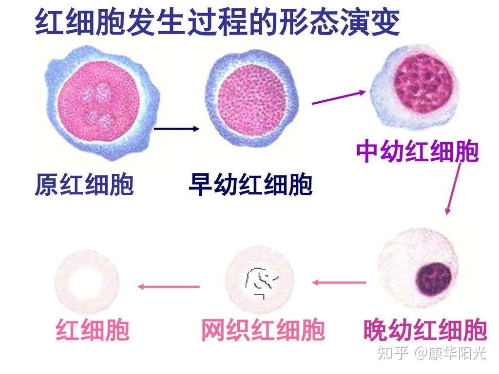 康华阳光案例3女57岁血红蛋白从88升到120不用再吃降压药