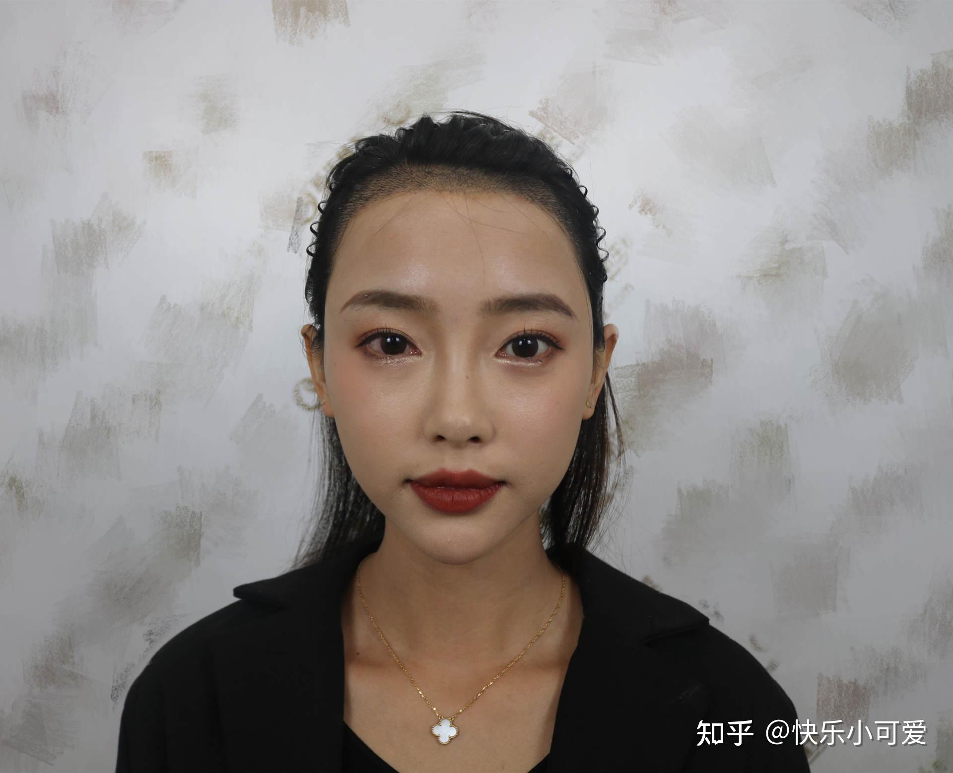 從禿頭女貝勒到靚發美少女的蛻變拯救髮際線實錄