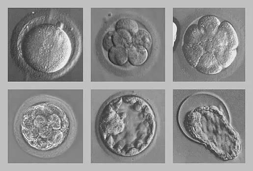 胚胎移植后在子宫图片图片