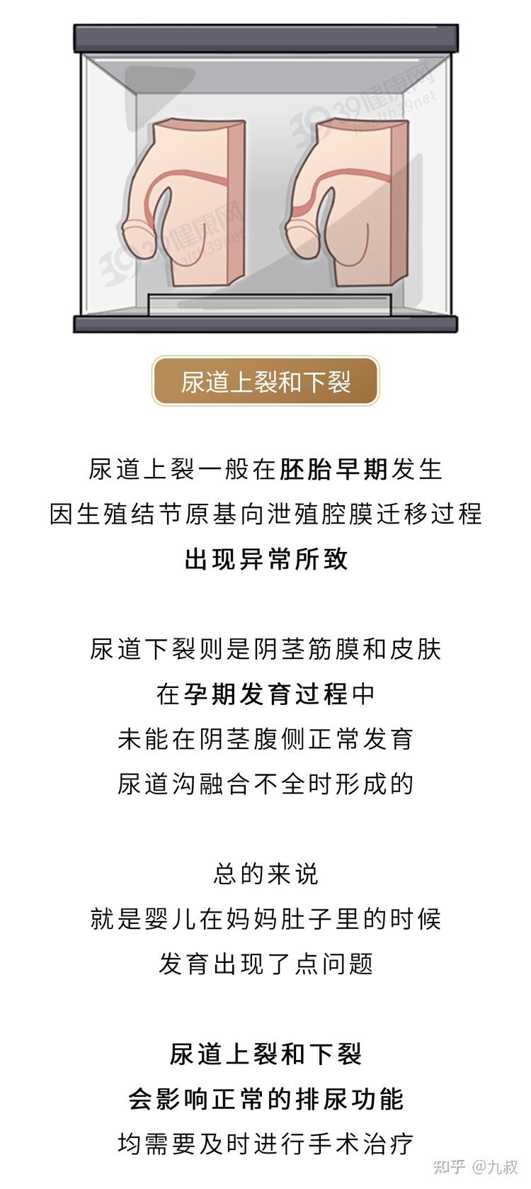 丁丁阴茎这些奇特形状希望你1个也没中