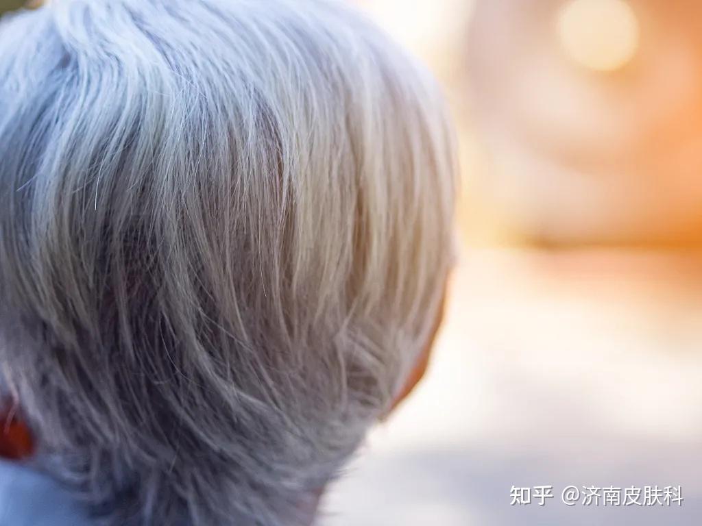 八十岁的老奶奶白发变黑发，原来是这个原因_李奶奶