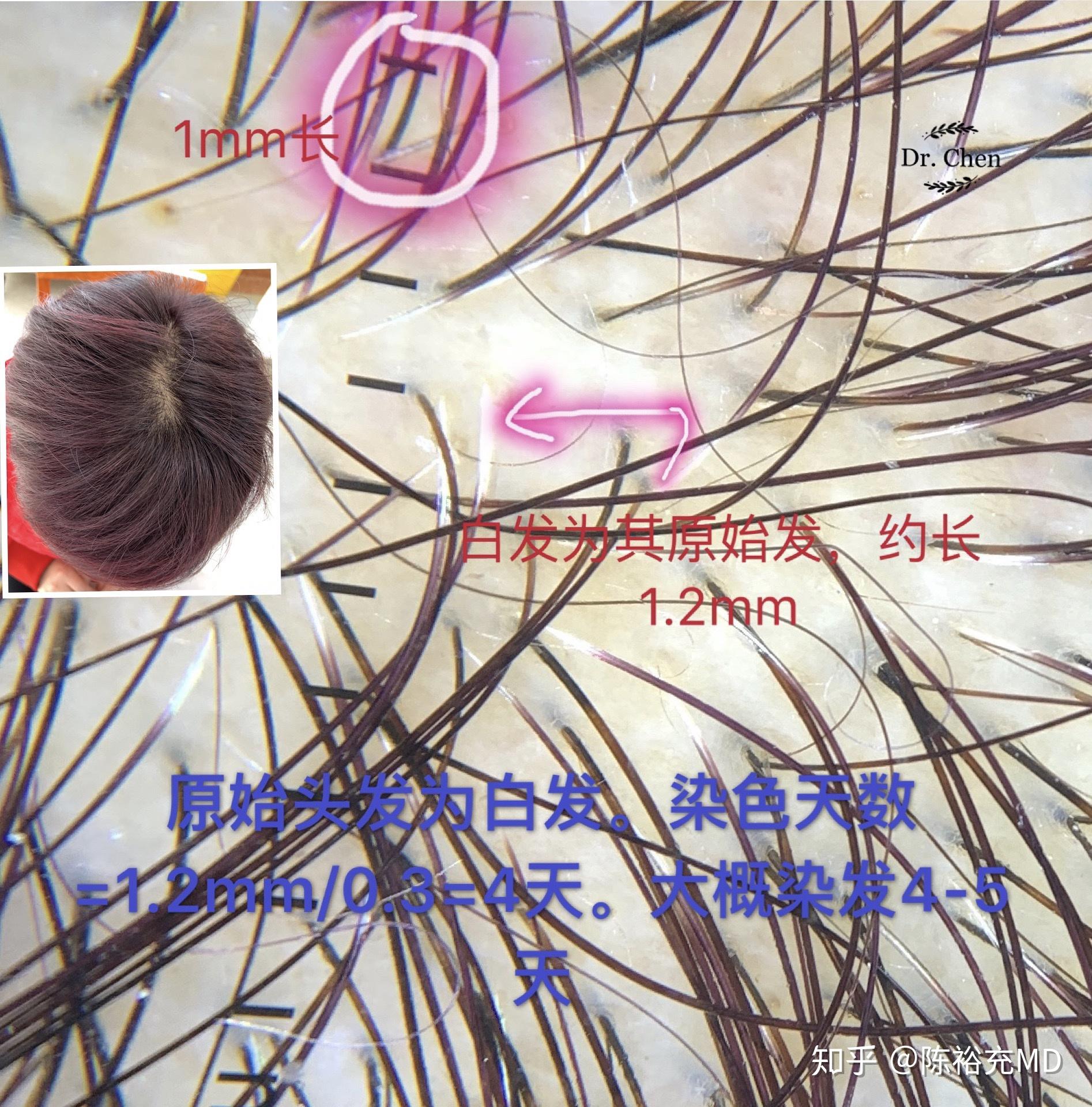 头发的生长速度有多快