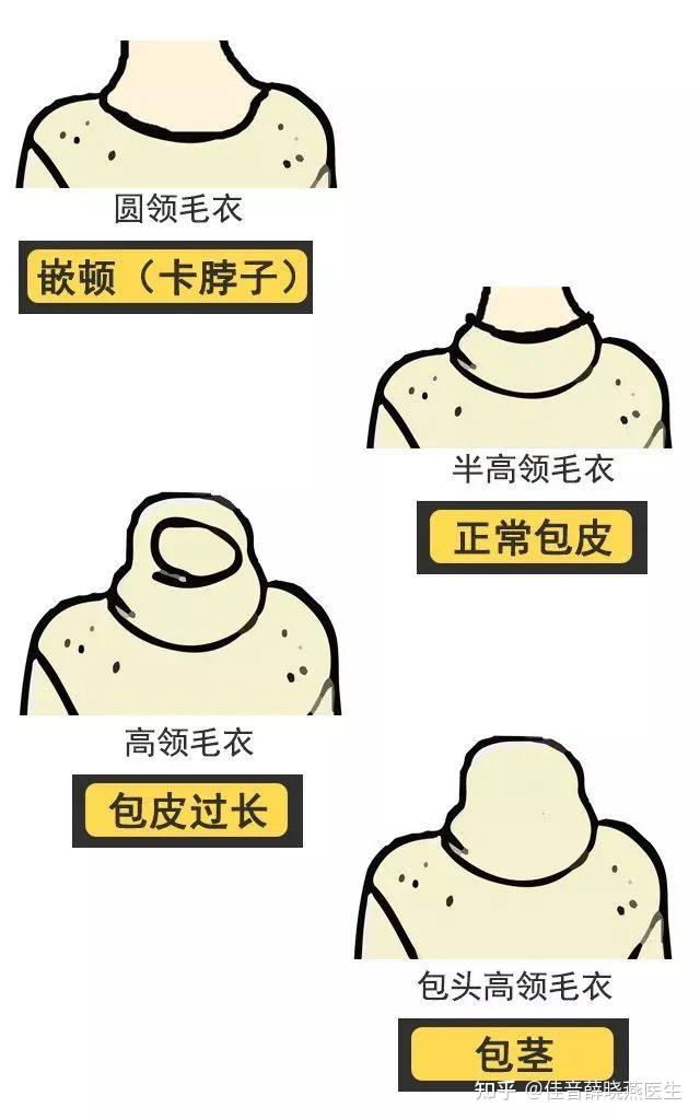 割包皮吗？当天做当天走的那种！ - 知乎