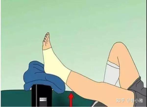 "肢体肿胀,疼痛,可采取抬高患肢,做冰敷,非固定部位加强活动等措施