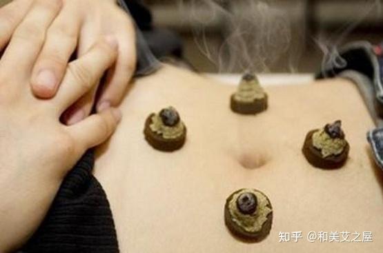 艾条与艾柱这俩到底是怎么用的