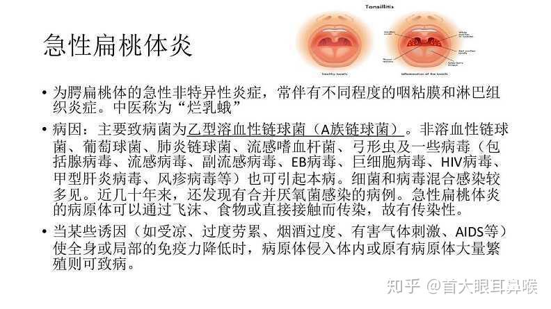 首大石萍慢性扁桃体炎防治重点在儿童时期