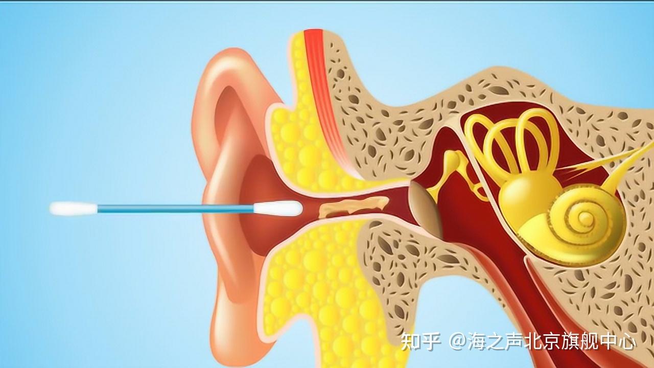 v2-85f627cb575151696845431d62f8da06_r.jpg