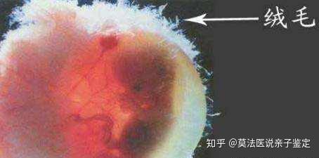 什么是胎儿亲子鉴定 需要提供什么样本 知乎