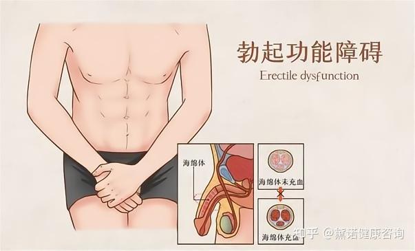 给"丁丁"打一针干细胞,可以再现男人雄风!