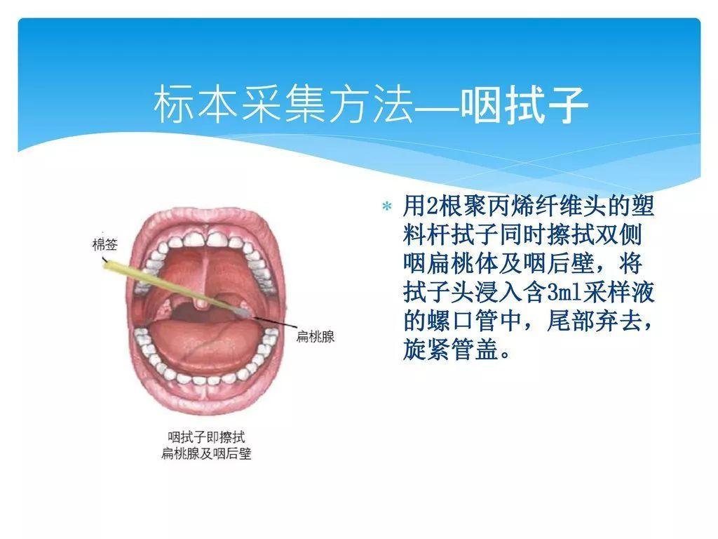 从试行第四版的诊疗方案可知,检验人员通过采集疑似病患的呼吸道标本