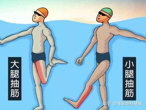 小腿抽筋,又叫肌肉痉挛,是指肌肉突然不自主的强直收缩,导致肌肉僵硬