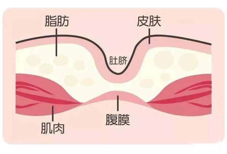 肚脐内部结构解剖图图片