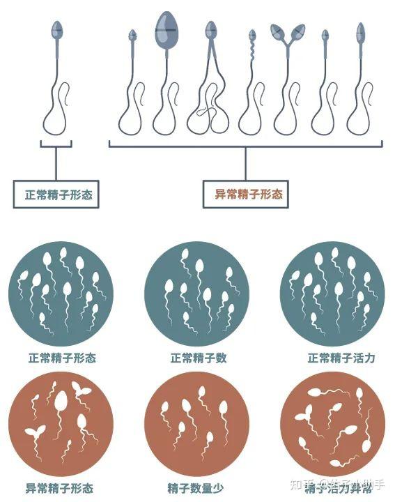 精子畸形率100%,试管婴儿还能成功吗? - 知乎