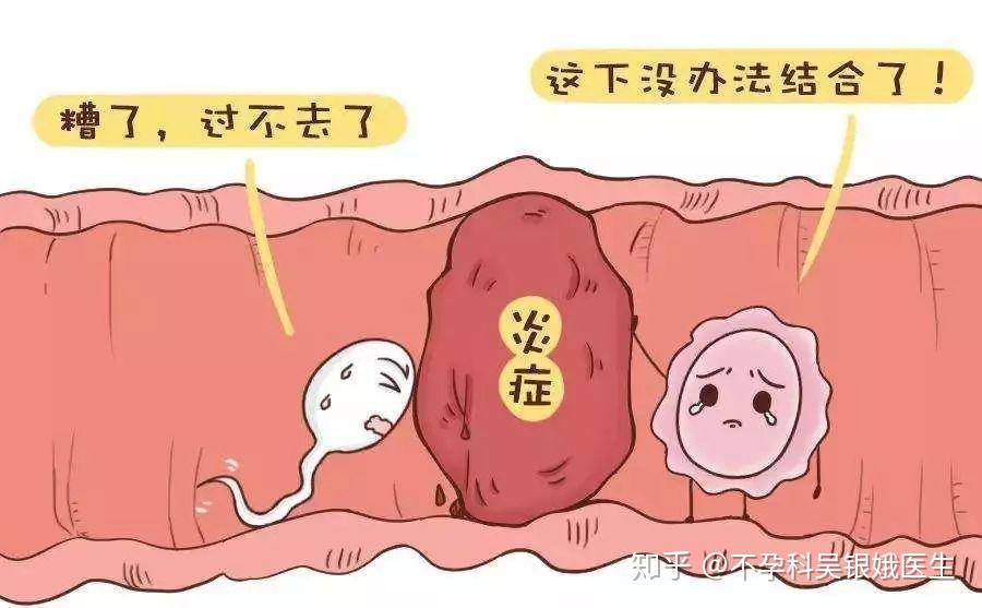 影响生育的重大输卵管功能障碍