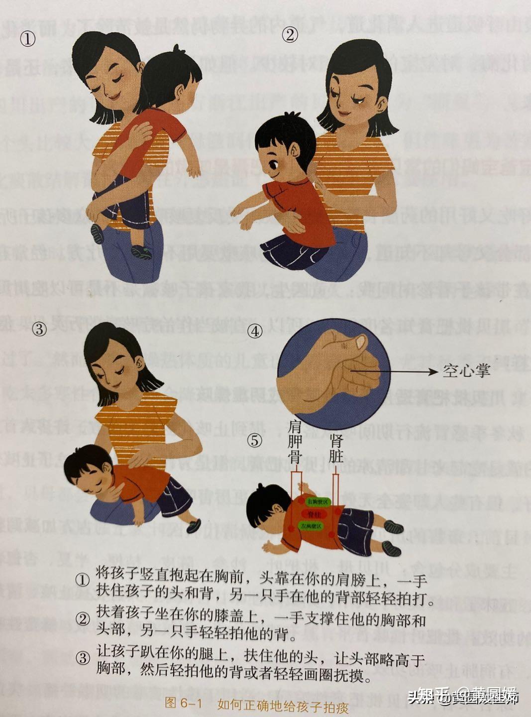 给宝宝拍背排痰图图片