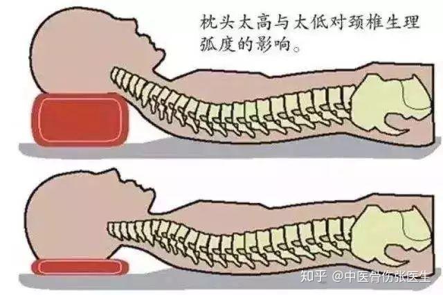 什么方法可以缓解颈椎疼痛 v2-86c5b6c466c24941a5d11ffb37a4be0a_r.jpg