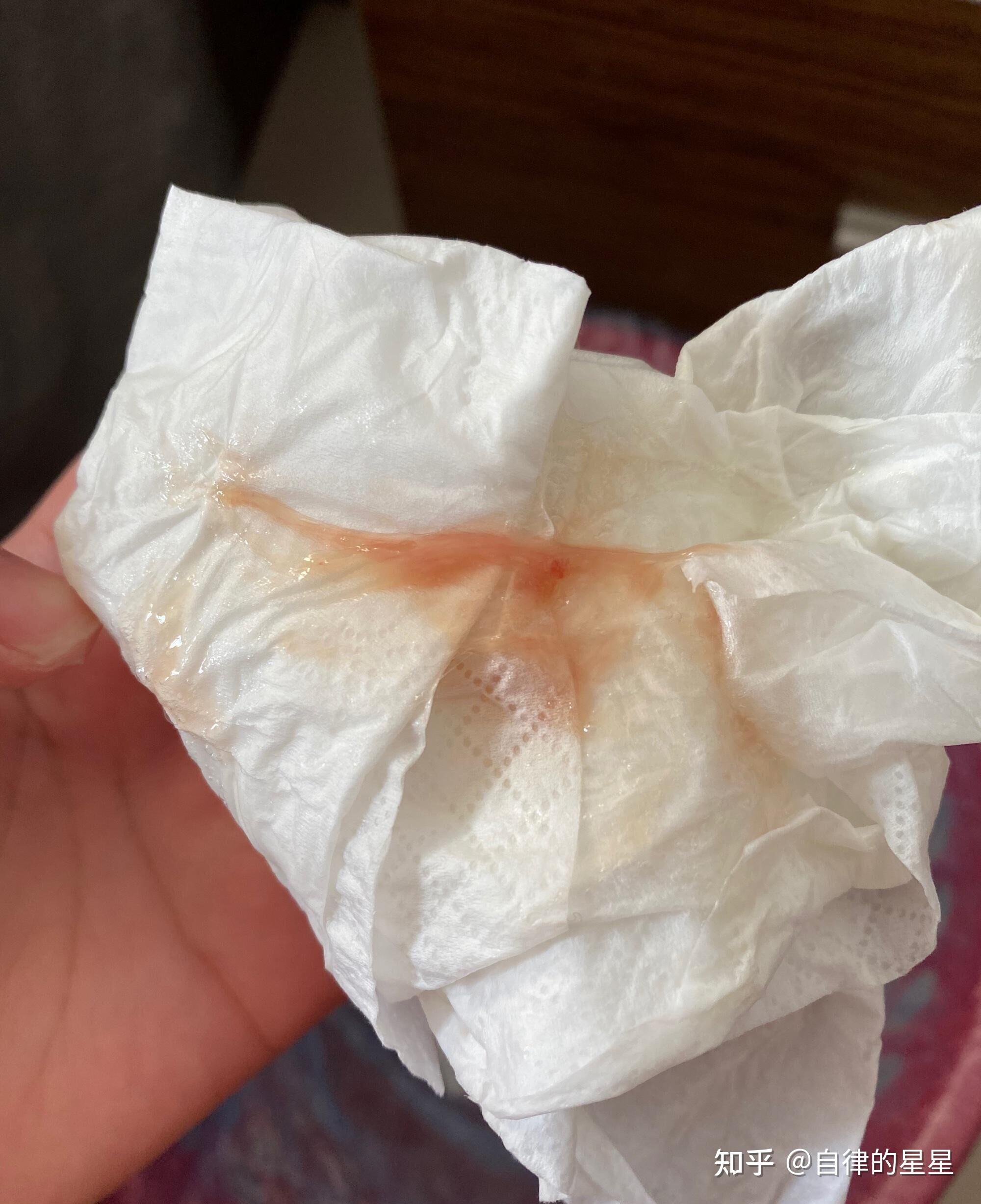 求助听人说锐王濞可宁说治鼻炎效果很好是真的吗