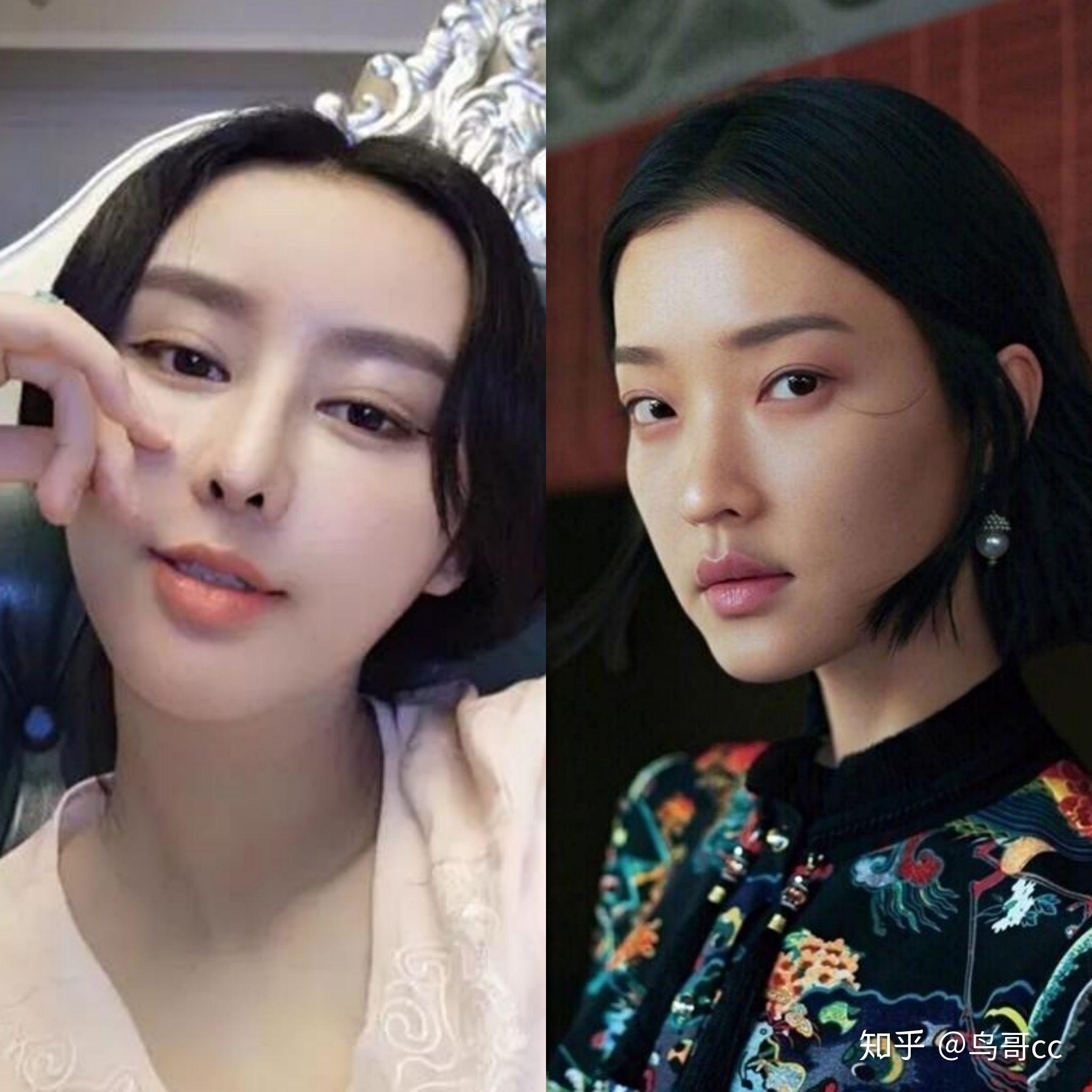 怎样才能杜绝翻车的整容脸