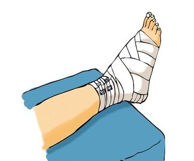 骨折后各个部位恢复时间对照表 知乎 骨折后各个部位恢复时间对照表 知乎