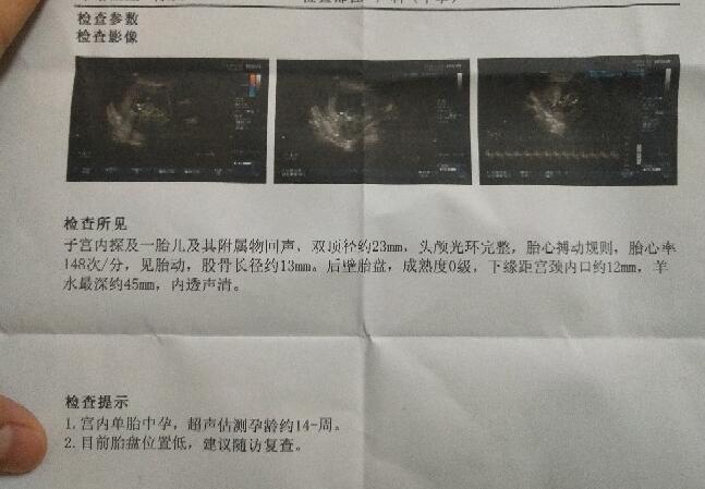 多年卵巢早衰治疗未果如今孕14周