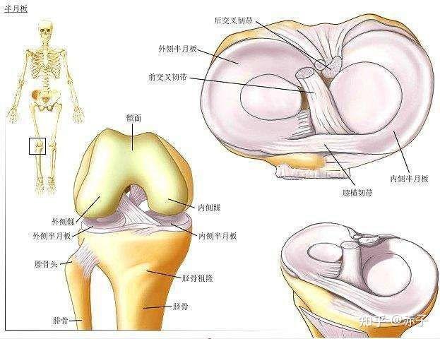 半月板损伤是什么感觉