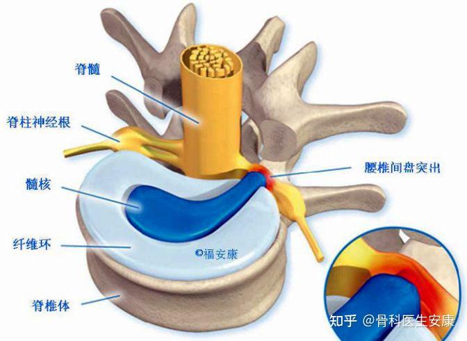 人体腰间盘位置图图片