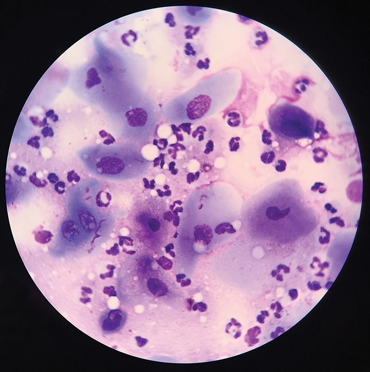 【眼科】角膜&结膜细胞学 - 知乎