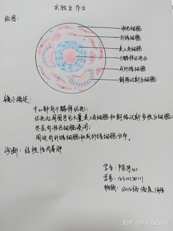 病理学红蓝铅笔绘图实验作业