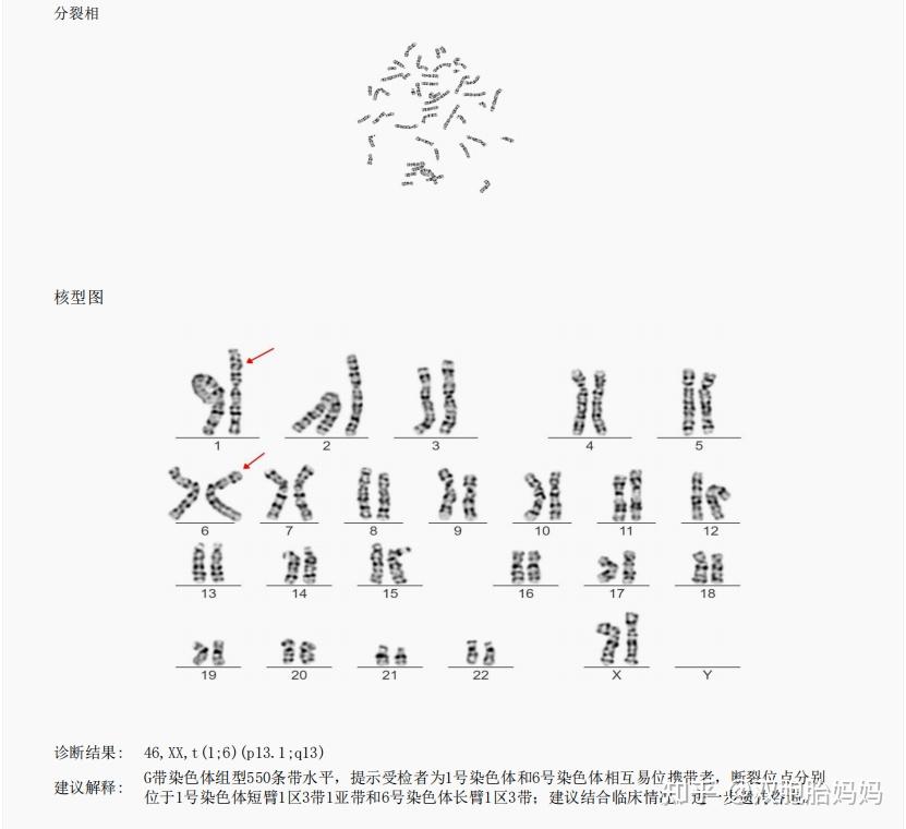 染色体查了,核型分析报告你知道怎么看不? - 知乎