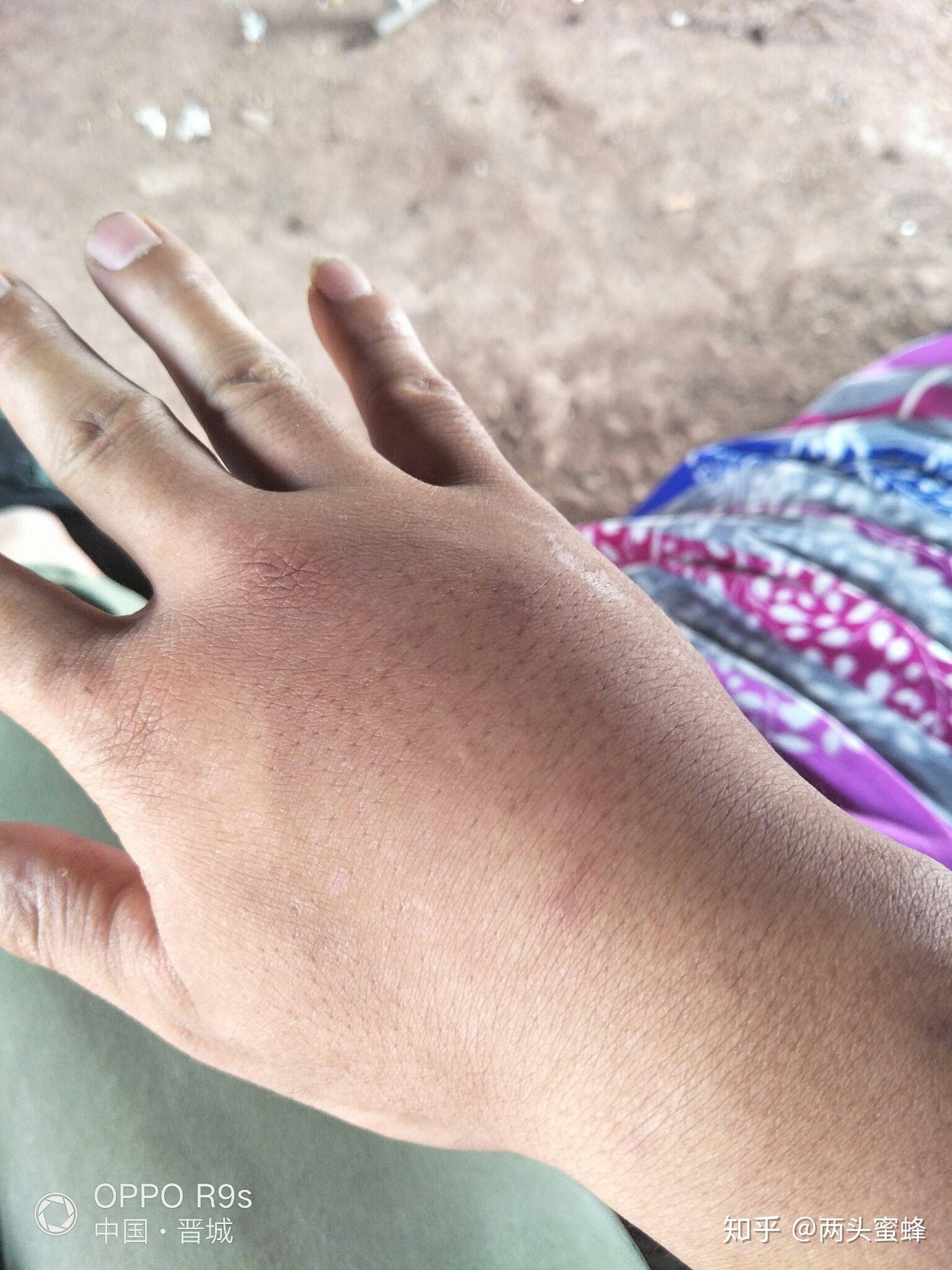 蜂蜜珍珠粉面膜,那个蜂蜜貌似是刚采集的,没处