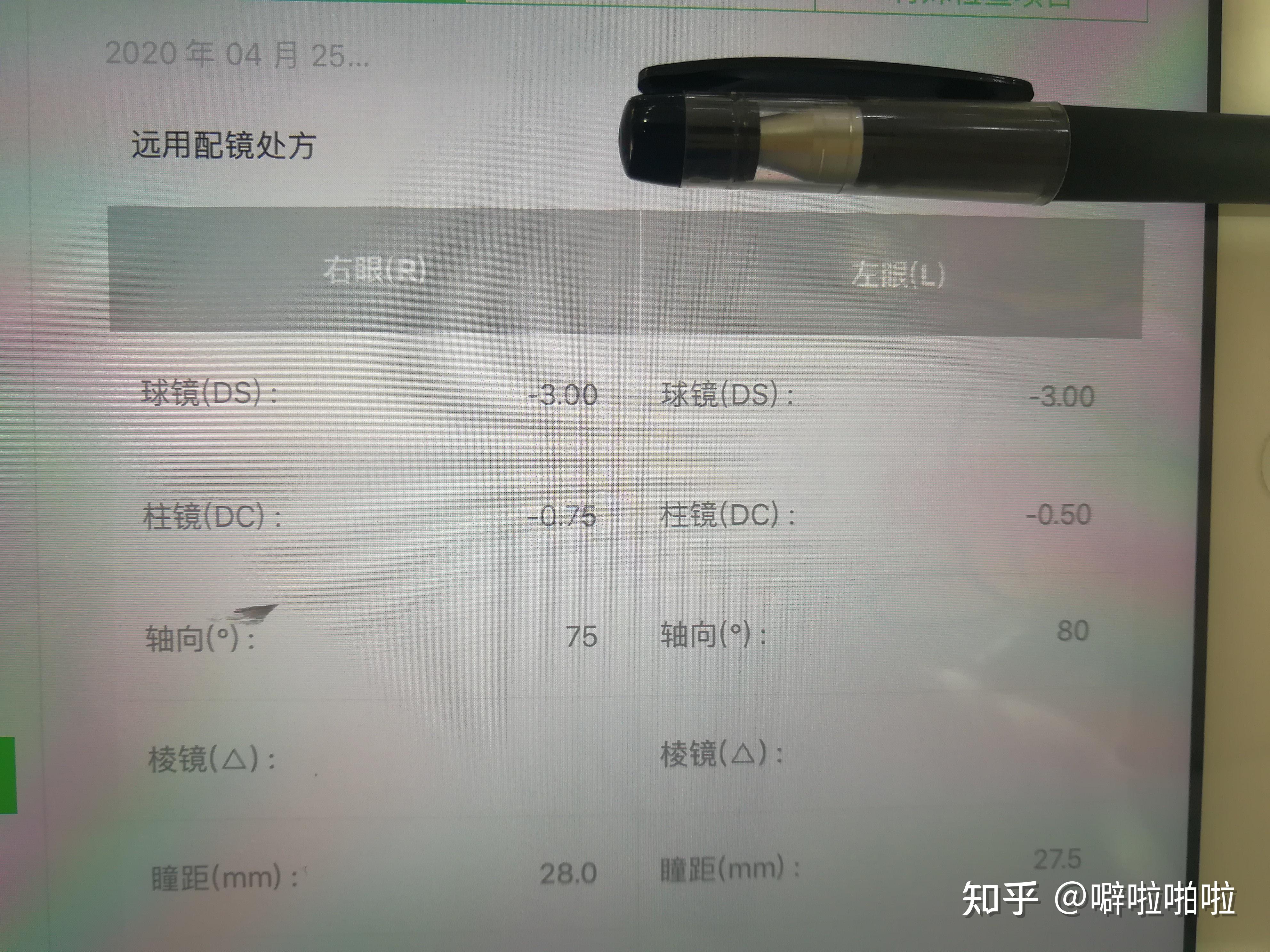 9歲孩子近視300度怎麼辦