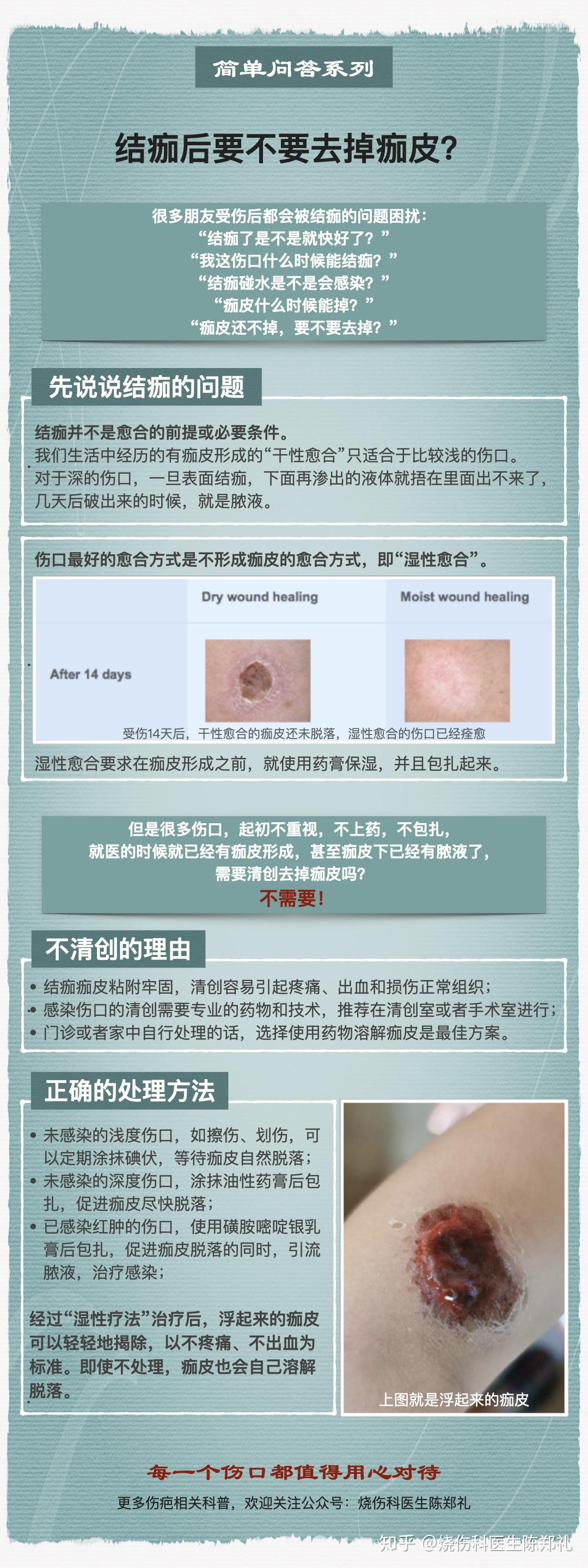 结痂后要不要去掉痂皮? - 知乎