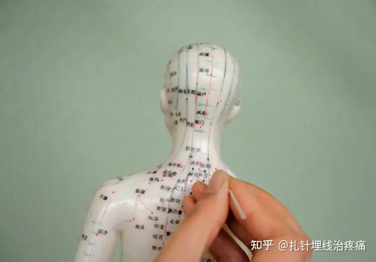 50种病证-针灸最常用穴位统计 - 知乎