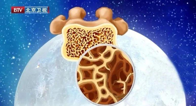 冠脉硬化、钙化，一字之差心梗风险翻倍！如何早发现、早预防？ 知乎 