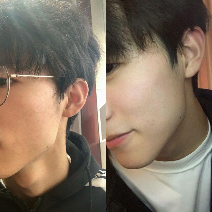 男生如何让皮肤变好