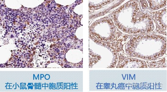 免疫组化(IHC)实验从入门要高阶一篇搞定 - 知乎