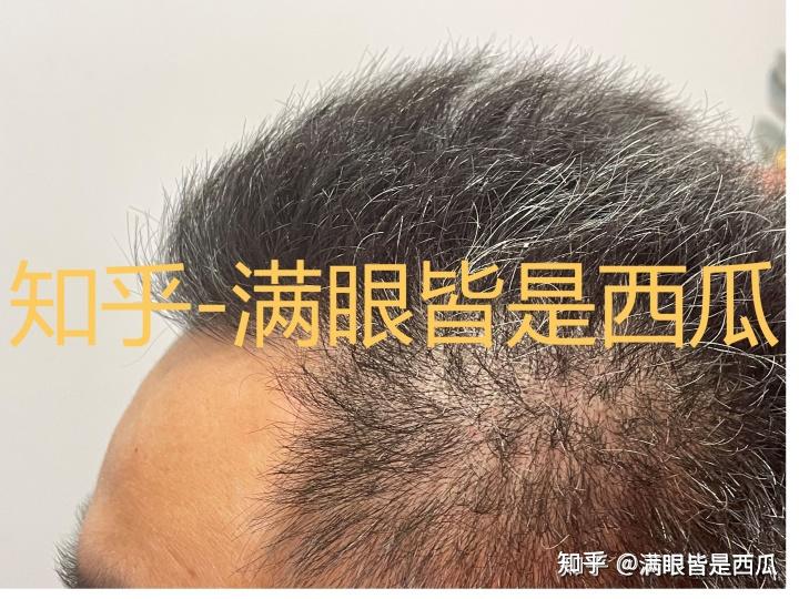 篇二【养发】真正懂头发的人,是怎么样养护头发的 - 知乎