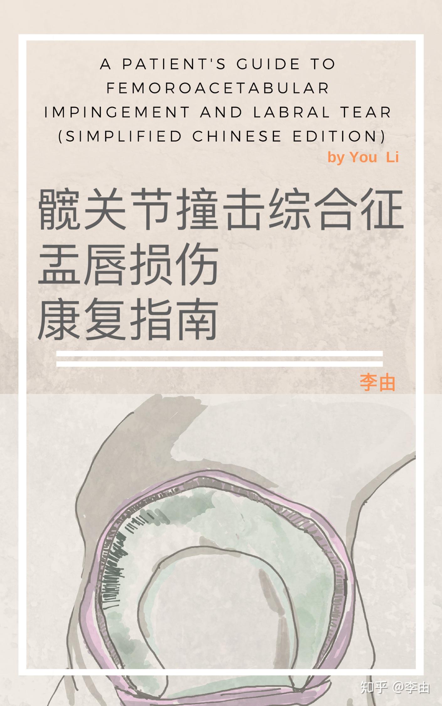 损伤康复指南 a patients guide to femoroacetabular impingement