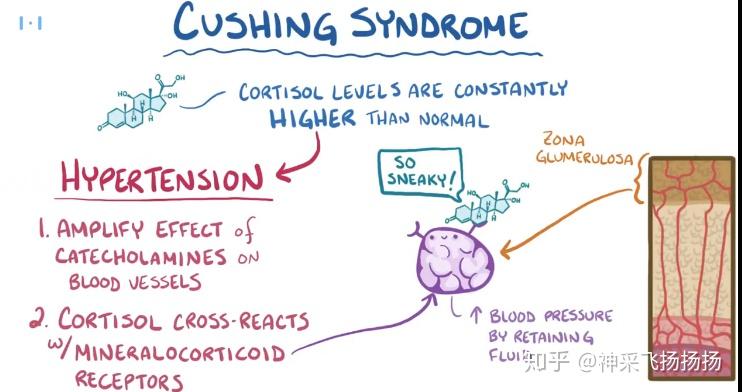医学科普之库欣综合征cushingsyndrome