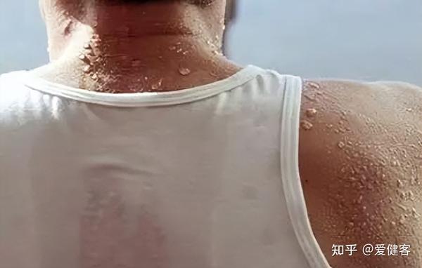 出汗多说明身体有问题?真相超乎你的想象 - 知乎