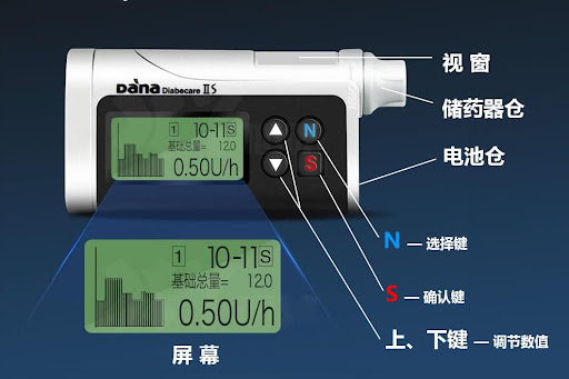 丹納胰島素泵的價格比美敦力親民許多,丹納iis和丹納r泵廠家報價分別