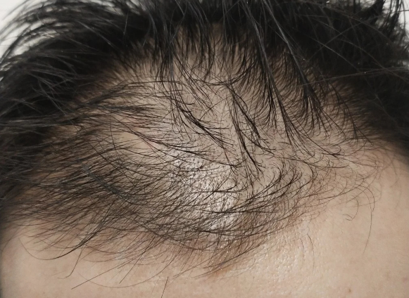 发质偏油性,干燥,稀疏,容易塌的男生适合用什么洗发水?