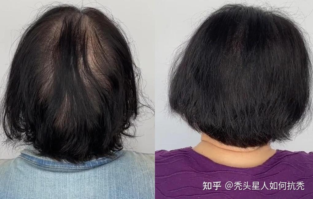 纹发全攻略：一站式了解前沿纹发技术 - 知乎